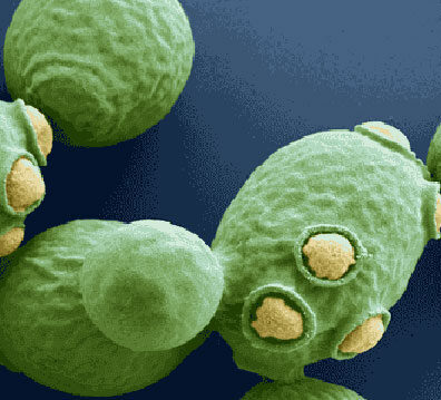o-que-sao-leveduras-o-que-e-saccharomyces-cerevisiae_20180717153155