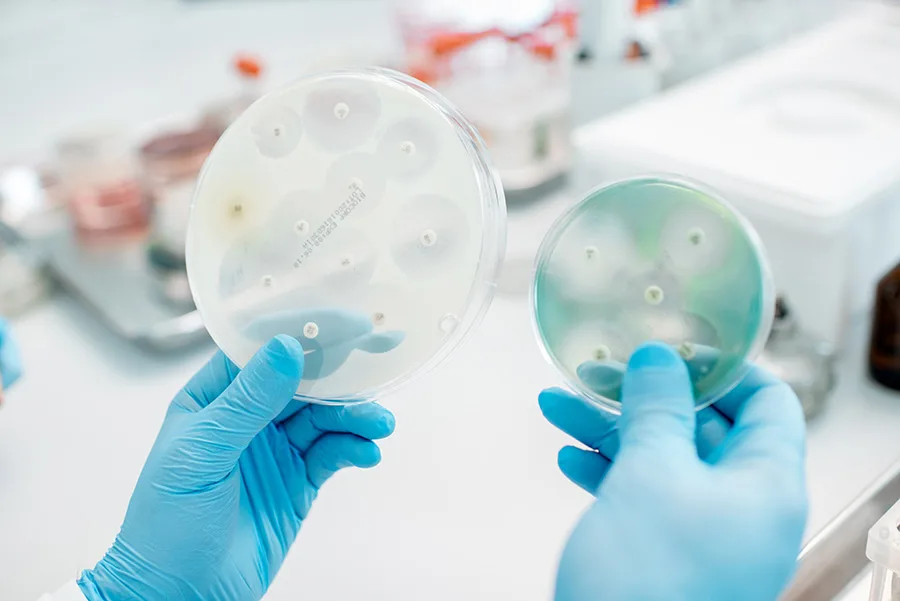 translocação bacteriana pode ser prevenida com probióticos